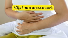 પેટમાં દુખાવો અને બળતરા ક્યારે બને છે કેન્સરનું કારણ? જાણો Stomach Cancer વિશે મહત્વની બાબતો