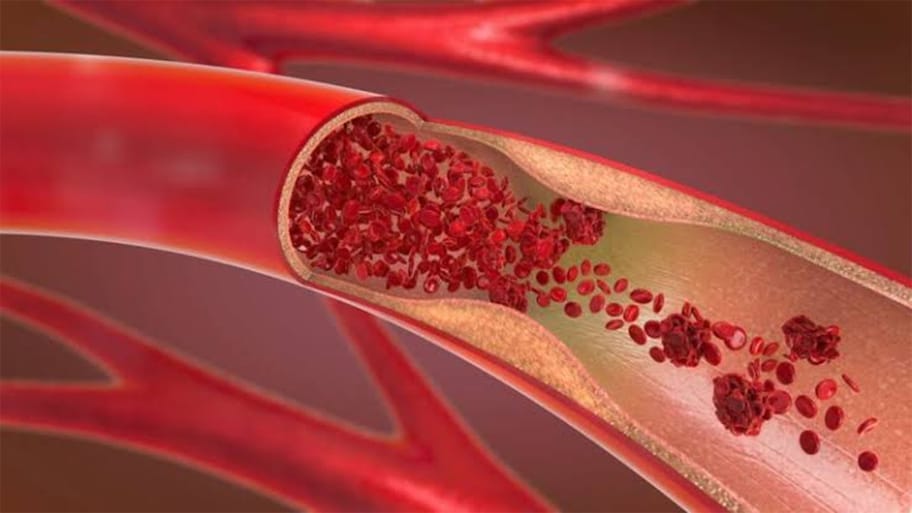 Good Cholesterol: શરીરમાં ગુડ કોલેસ્ટ્રોલ વધારવા પર પણ આપો ધ્યાન, જાણી લો કઈ વસ્તુઓ વધારે ગુડ કોલેસ્ટ્રોલ ?