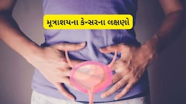 પેશાબ કરવા સમયે આ લક્ષણ જોવા મળે તો નજરઅંદાજ ન કરો, હોઈ શકે છે Bladder Cancer