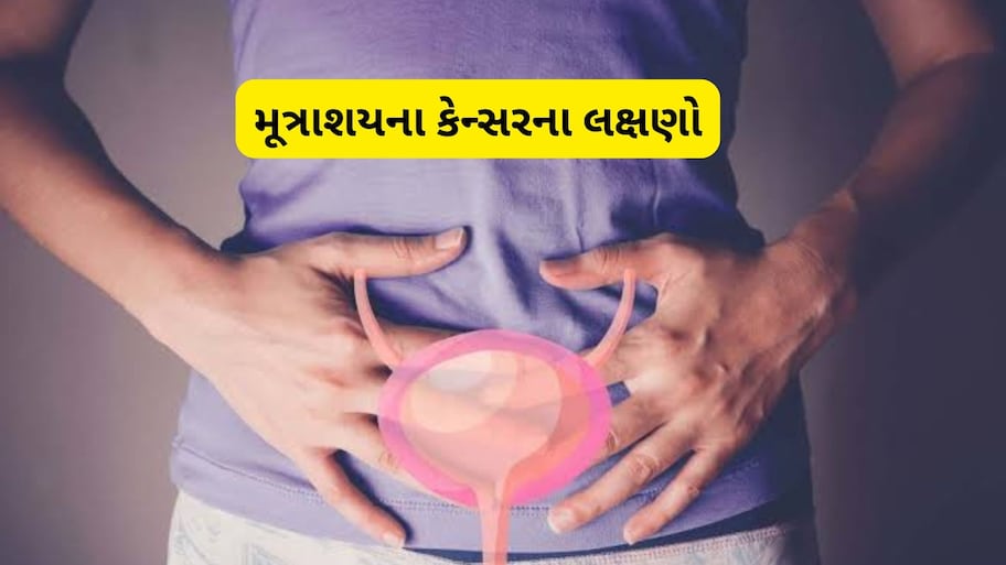 પેશાબ કરવા સમયે આ લક્ષણ જોવા મળે તો નજરઅંદાજ ન કરો, હોઈ શકે છે Bladder Cancer