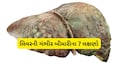 શરીરના આ મહત્ત્વના અંગને ન કરો નજરઅંદાજ; જાણો લિવર સિરોસિસના શરૂઆતી સંકેતો અને બચાવના ઉપાય