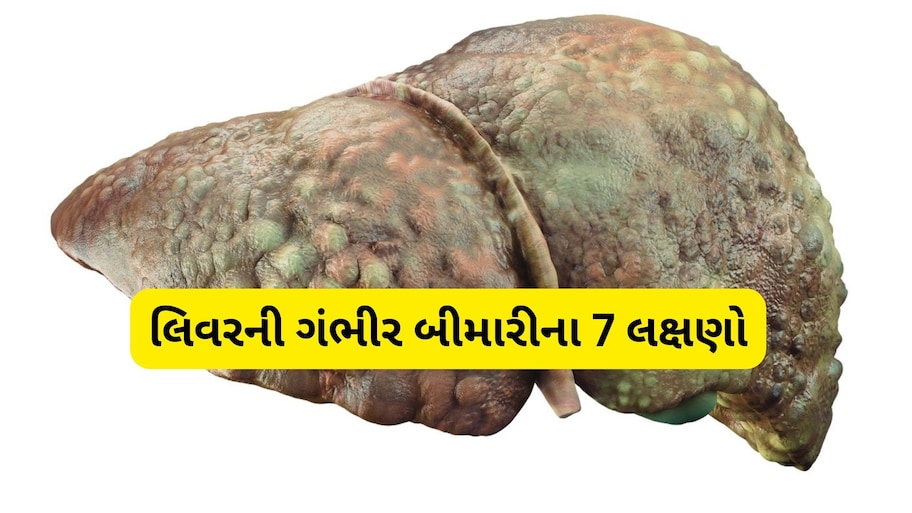 શરીરના આ મહત્ત્વના અંગને ન કરો નજરઅંદાજ; જાણો લિવર સિરોસિસના શરૂઆતી સંકેતો અને બચાવના ઉપાય