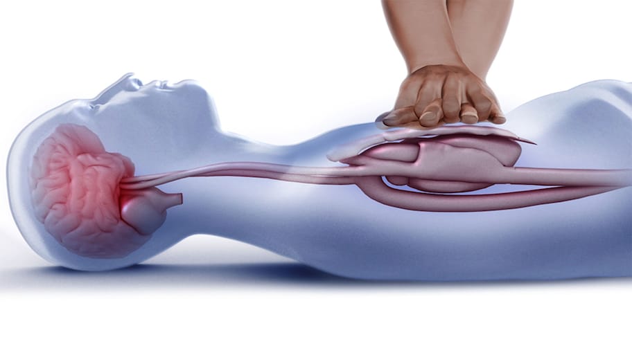 How To Give CPR: આ સ્થિતિમાં દર્દીને CPR આપવાનું ટાળવું, જાણો CPR આપવાની સાચી રીત