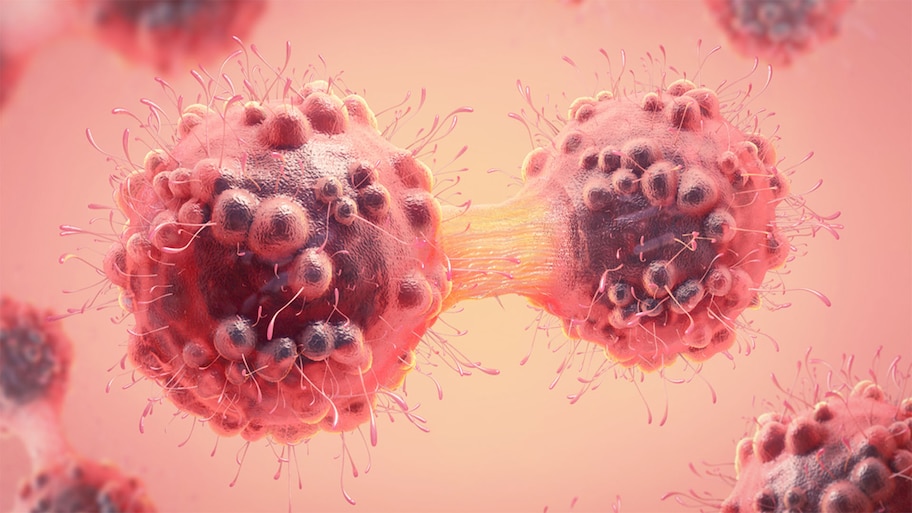 Cancer Warning Signs: કેન્સરના ગાંઠ સિવાયના સંકેતો, શરીરમાં થતા આ ફેરફાર પણ હોય શકે છે કેન્સરનું લક્ષણ