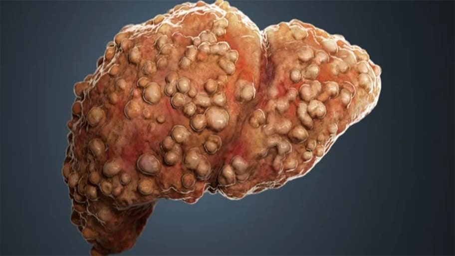 Liver Health: લીવરમાં જમા ફેટ ઓગાળી બહાર કાઢી નાખે તેવા 4 દેશી પીણાં, લીવર થઈ જશે ડિટોક્સ