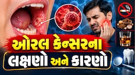 મોંમાં ચાંદા અને ગાંઠ: ઓરલ કેન્સરના શું હોઈ શકે લક્ષણો? AIIMS ના ડૉક્ટરે જણાવ્યા ચેતવણીરૂપ સંકેતો અને બચવાના ઉપાયો